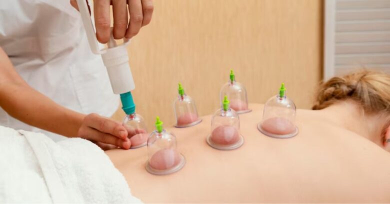 The Best Cupping Massage Near Me: Health Benefits & More 2 The Best Cupping Massage Near Me: Health Benefits & More
