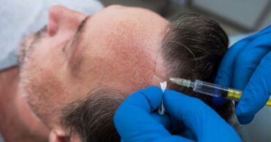 hair transplant cost australia: What to Expect in 2025